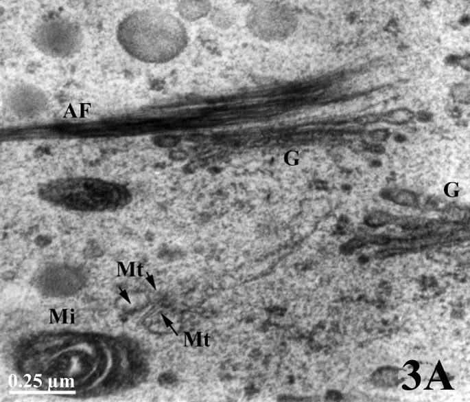 Transmission Electron