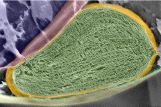 Scanning electron microscopy of a chloroplast