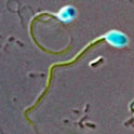Voor onderzoek fluorescerend gelabelde spermacel van de mens