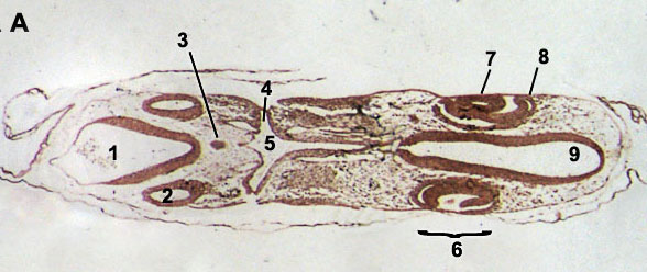 Eye formation embryology chicken