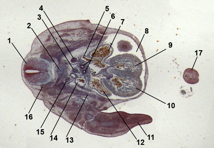 embryo of mouse, 13 days old; heart formation