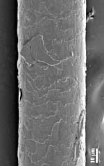 Surface of a scalp hair: scale structure