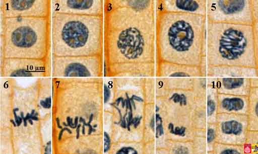 Stages of mitosis in onion root tip cells