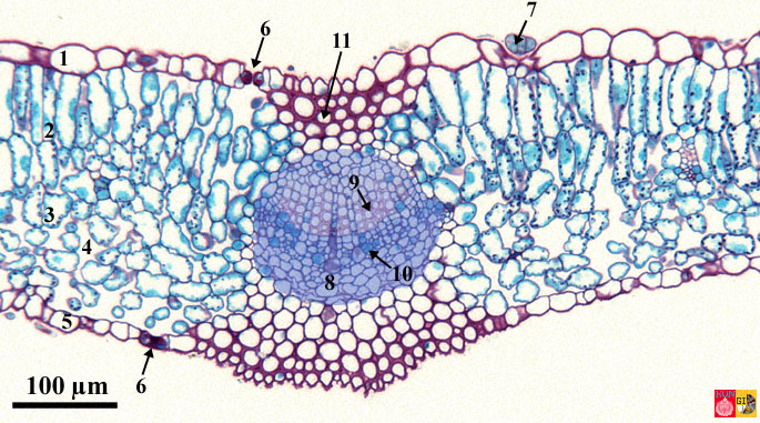 Stained cross-section through a leaf of lilac
