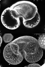 Conventional versus confocal fluorescence microscopy
