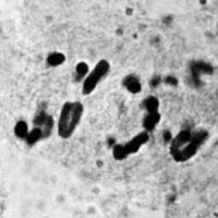 meiosis: anaphase I in Locusta