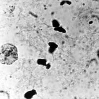 meiose: zijaanzicht van metafase I in Locusta
