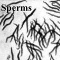 Spermacellen van de sprinkhaan