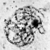 meiosis: zygotene in Locusta