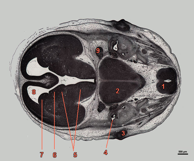 E16-07-hor-489-labels section of rat embryo