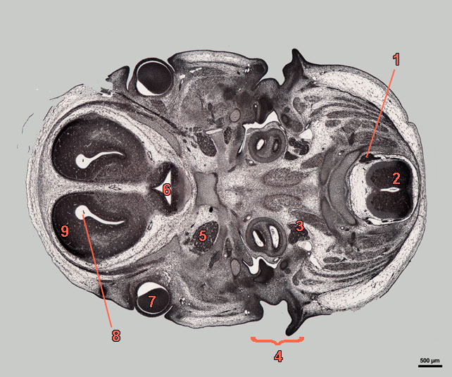 E16-07-hor-589-labels section of rat embryo