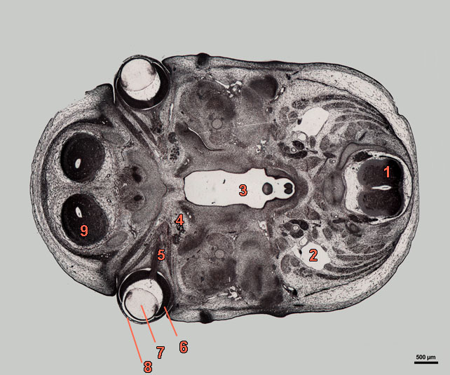 E16-07-hor-639-labels section of rat embryo