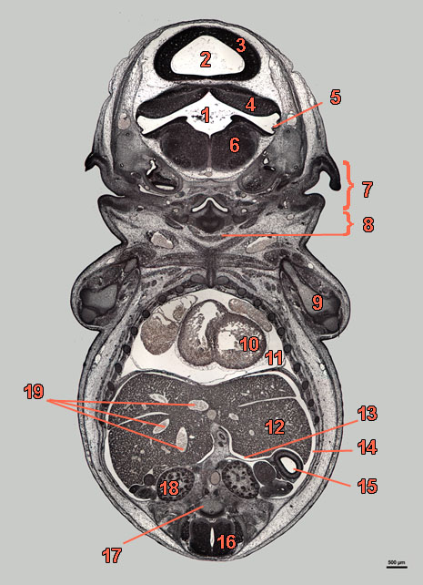 E16-09-front-639-labels section of rat embryo