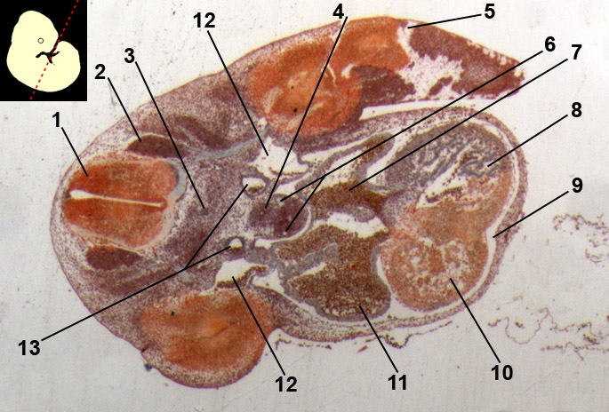 embryology mouse 11 days old; heart region