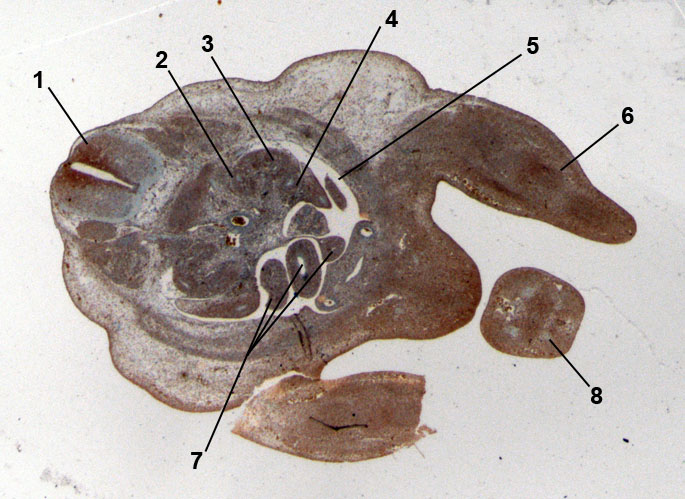 Gut region 13-days old embryo of the mouse