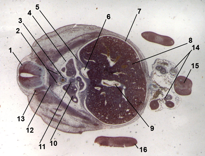 lung and liver region in a 13-days old embryo of mouse