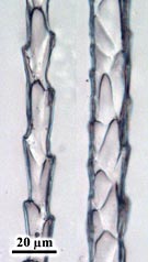 Gelatine afdruk van het cuticulair patroon van een haar van de waterspitsmuis