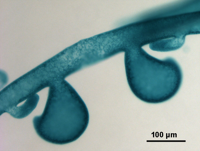 Filament, antheridium, oogonium of Vaucheria