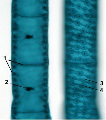 spirogyra-anatomy