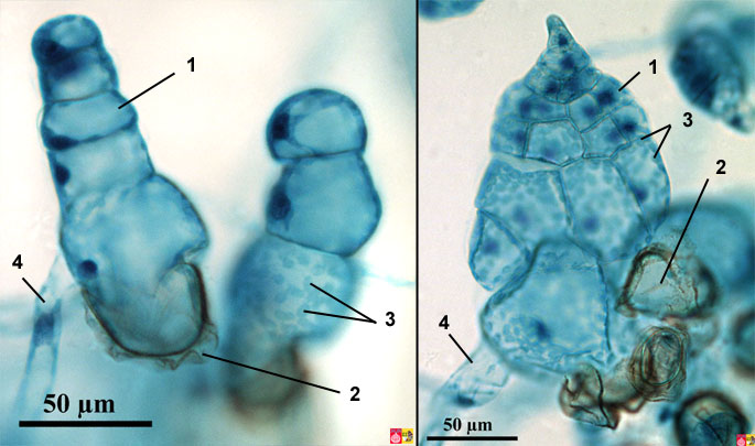 fern germinating prothallium