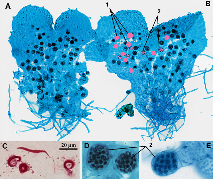 prothallium of true ferns, antheridia, sperm cells