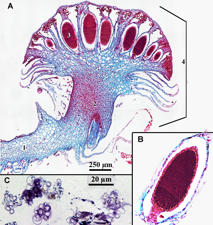 Lichtmicroscopische opname van antheridiofoor van Marchantia