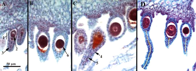 Macrophoto and light microscopical view of archegonia of Marchantia with egg cells