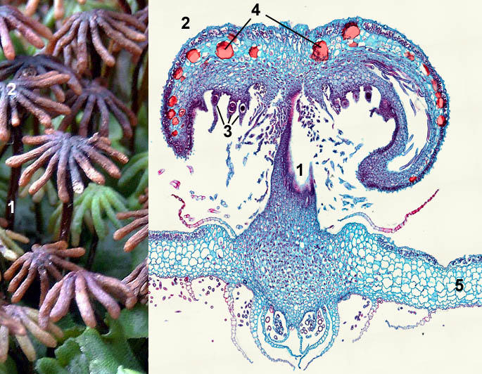 Macrofoto en lichtmicroscopische opname van archegonioforen van Marchantia; foto Ted van Gaalen, Liesbeth Pierson