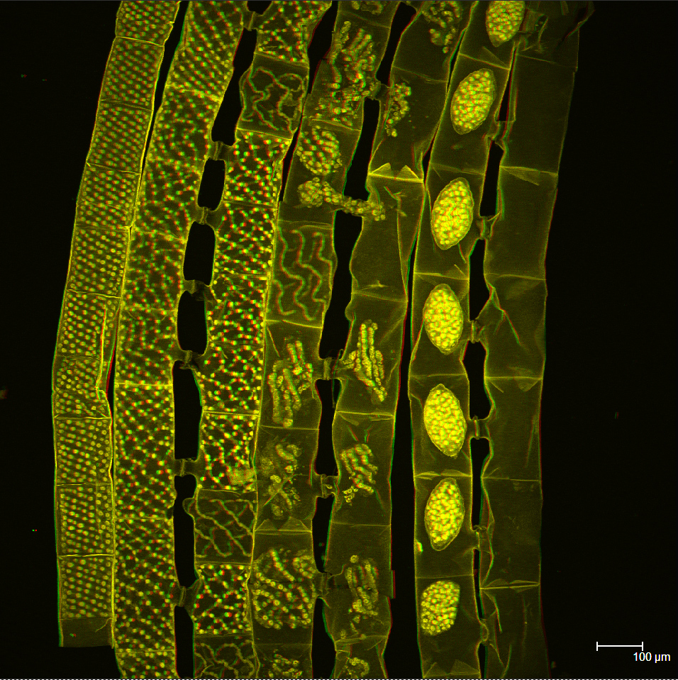 life cycle of Spirogyra- stereo image
