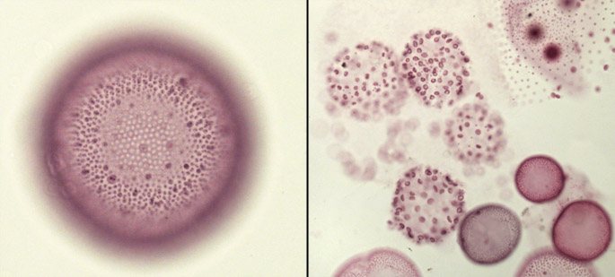 Volvox colonies: in quiescence and during inversion