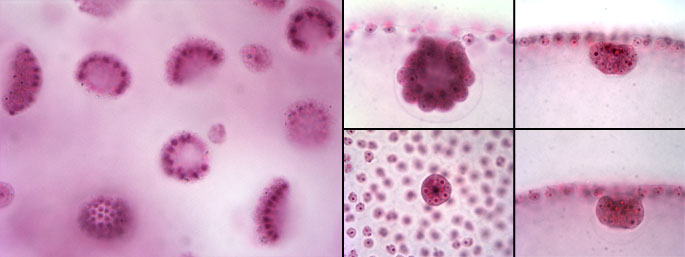 Volvox colonies: detail of inversion during vegetative reproduction