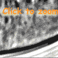 Image ultraviolet microscopy