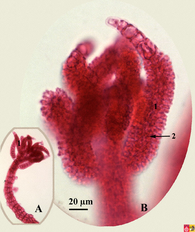 Красные водоросли клетки. Полисифония водоросль. Красные водоросли полисифония. Polysiphonia Fucoides. Цистокарпий полисифонии.